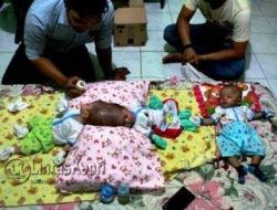 Bayi Kembar Siam 6 Kilogram Tunggu Dioperasi