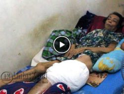 Video Penderita Tumor Ganas Kurang Perhatian Pemerintah