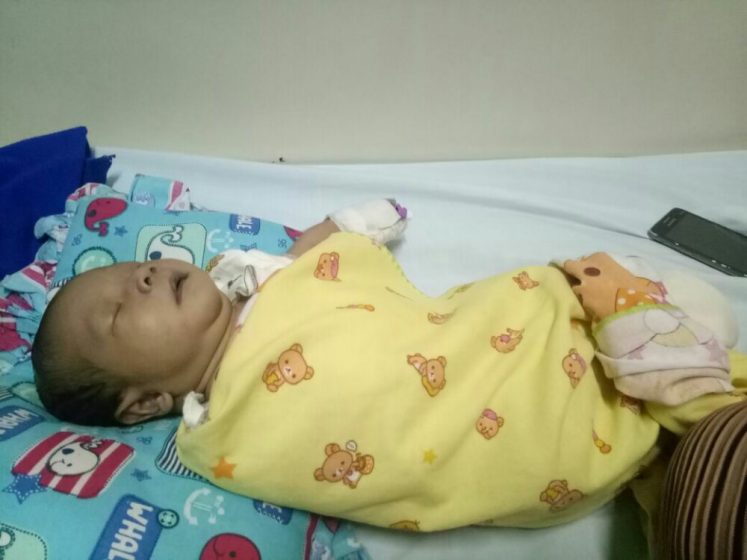 Bayi Arkan yang divonis dokter mengalami kebocoran Jantung Dirawat di RSUP Kepri