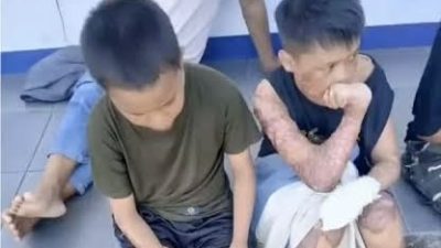 1 Santri Tewas, Dua Alami Luka Bakar Serius, Dugaan Pembakaran di Ponpes Lombok Tengah Masuk Tahap Penyidikan