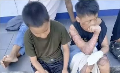 1 Santri Tewas, Dua Alami Luka Bakar Serius, Dugaan Pembakaran di Ponpes Lombok Tengah Masuk Tahap Penyidikan. Dok : istimewa